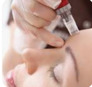 MICRO NEEDLING