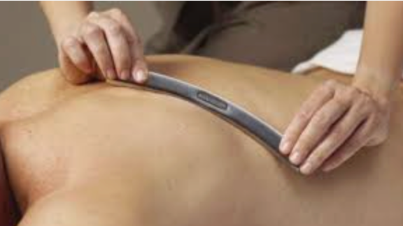 MUSCLE SCRAPING       /      Metal tool-assisted technique to release scar tissue and improve mobility.