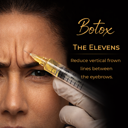 Botox for The Elevens (Glabellar Complex) 24 units